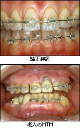 矯正治療